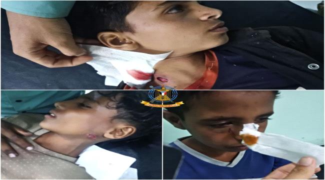 إصابة 3 أطفال بانفجار مقذوف حوثي في الضالع